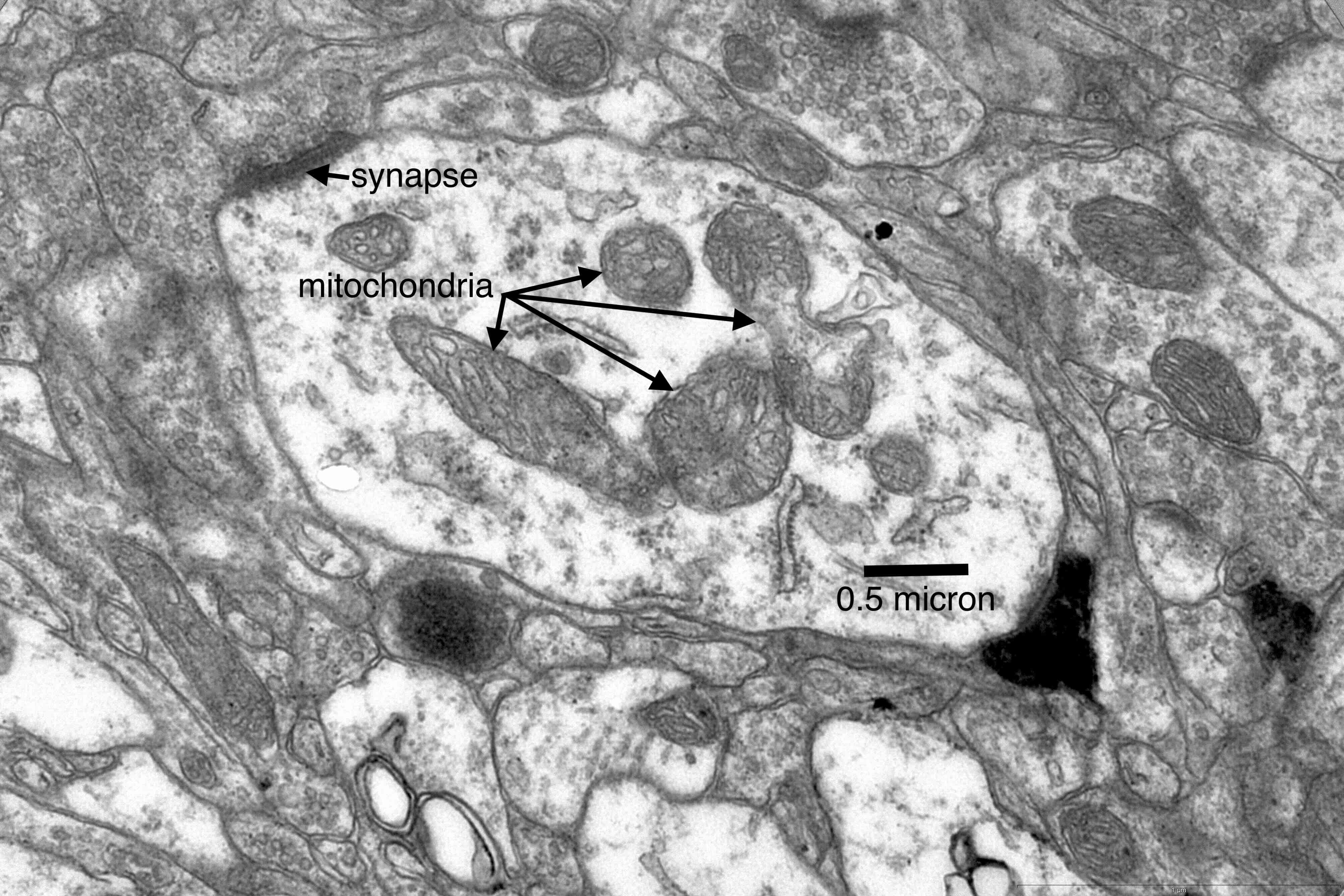 mitochondria-bt08 E5-01 34k